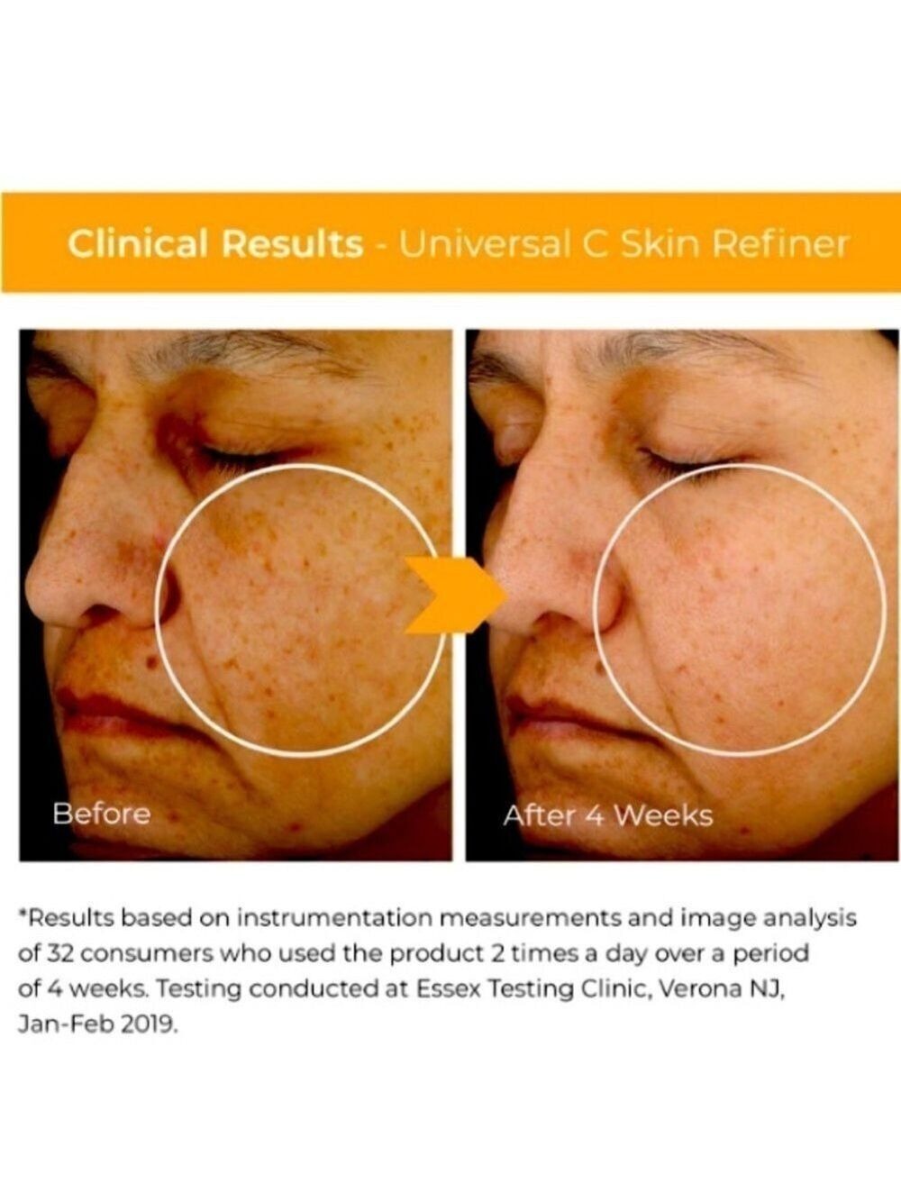 BeautyStat Universal Vitamin C Refiner Serum 20% L-Ascorbic Acid - Picture 6 of 16